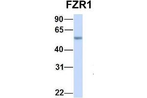 Host:  Rabbit  Target Name:  FZR1  Sample Type:  Human Fetal Lung  Antibody Dilution:  1.