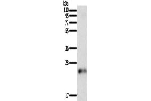 Gel: 12 % SDS-PAGE, Lysate: 50 μg, Lane: Human fetal brain tissue, Primary antibody: ABIN7129442(FAM3A Antibody) at dilution 1/200, Secondary antibody: Goat anti rabbit IgG at 1/8000 dilution, Exposure time: 5 minutes (FAM3A antibody)