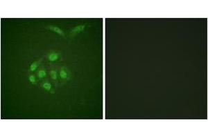 Immunofluorescence analysis of A549 cells, using Survivin (Phospho-Thr117) Antibody.