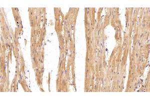 Detection of GSN in Rat Cardiac Muscle Tissue using Polyclonal Antibody to Gelsolin (GSN)