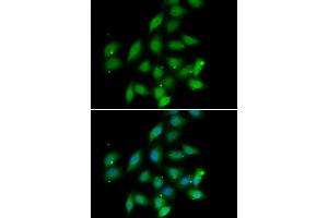 Immunofluorescence analysis of HeLa cells using PPP2CA antibody. (PPP2CA antibody)