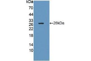 Western blot analysis of recombinant Human CTRB1. (CTRB1 antibody  (AA 34-261))