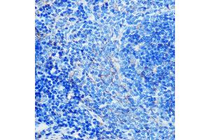 Immunohistochemistry of paraffin-embedded mouse spleen using CD23 Rabbit mAb (ABIN7267160) at dilution of 1:100 (40x lens). (FCER2 antibody)