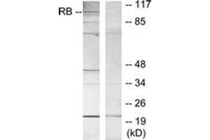 Western blot analysis of extracts from MOLT cells, using Retinoblastoma (Ab-807) Antibody. (Retinoblastoma Protein (Rb) antibody  (AA 781-830))
