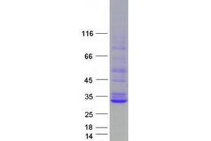 Steroidogenic Acute Regulatory Protein (STAR) (Transcript Variant 2) protein (Myc-DYKDDDDK Tag)
