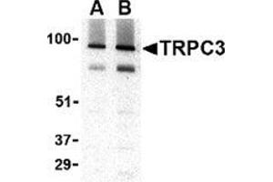 Western blot analysis of TRPC3 in human brain tissue lysate with this product at (A) 1 and (B) 2 μg/ml.