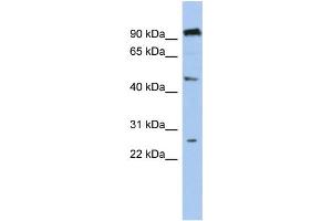 WB Suggested Anti-C1orf174  Antibody Titration: 0. (C1orf174 antibody  (Middle Region))