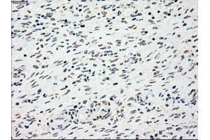 Immunohistochemical staining of paraffin-embedded liver tissue using anti-CHEK2mouse monoclonal antibody.