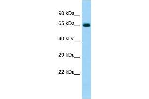 Host: Rabbit Target Name: COL6A5 Sample Type: Fetal Heart lysates Antibody Dilution: 1. (Collagen, Type VI, alpha 5 (COL6A5) (C-Term) antibody)
