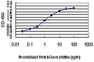 Detection limit for recombinant GST tagged ZIC4 is approximately 0. (ZIC4 antibody  (AA 249-319))