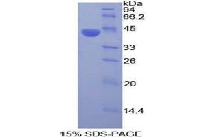 SDS-PAGE (SDS) image for Ceruloplasmin (Ferroxidase) (CP) (AA 729-1061) protein (His tag) (ABIN2124303)