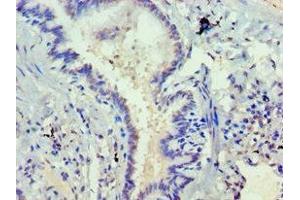 Immunohistochemistry of paraffin-embedded human lung tissue using ABIN7168752 at dilution of 1:100 (DVL2 antibody  (AA 1-240))