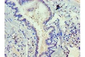Immunohistochemistry of paraffin-embedded human lung tissue using ABIN7168752 at dilution of 1:100