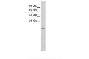 Image no. 2 for anti-Solute Carrier Family 25, Member 45 (SLC25A45) (C-Term) antibody (ABIN205010) (SLC25A45 antibody  (C-Term))