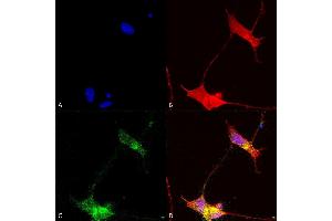 Immunocytochemistry (ICC) image for anti-SH3 and Multiple Ankyrin Repeat Domains 2 (SHANK2) (AA 84-309) antibody (ABIN863120)