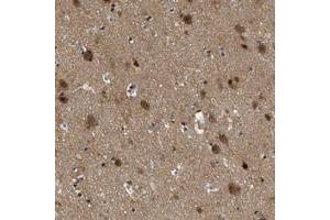 Immunohistochemical staining of human cerebral cortex with ZBTB11 polyclonal antibody  shows cytoplasmic positivity in neuronal cells at 1:20-1:50 dilution.