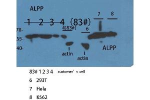 Western Blotting (WB) image for anti-Placental Alkaline Phosphatase (ALPP) (N-Term) antibody (ABIN3187883) (PLAP antibody  (N-Term))