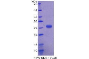 SDS-PAGE (SDS) image for Haptoglobin (HP) (AA 159-329) protein (His tag) (ABIN2125136) (Haptoglobin Protein (HP) (AA 159-329) (His tag))
