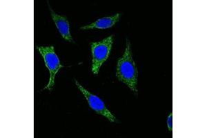 Confocal immunofluorescence analysis of methanol-fixed Eca-109 cells using Cytokeratin (Pan) antibody (green), showing cytoplasmic localization. (pan Keratin antibody)