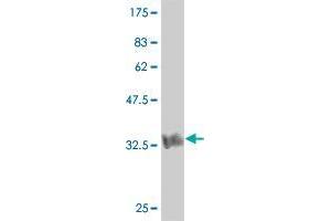 Western Blot detection against Immunogen (36. (HUNK antibody  (AA 615-714))