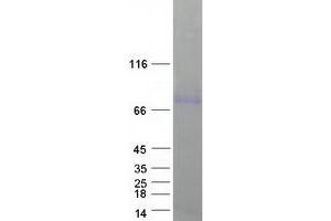 Validation with Western Blot (SMPD1 Protein (Transcript Variant 1) (Myc-DYKDDDDK Tag))