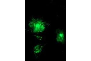 Anti-APP mouse monoclonal antibody (ABIN2455923) immunofluorescent staining of COS7 cells transiently transfected by pCMV6-ENTRY APP (RC221339). (APP antibody)