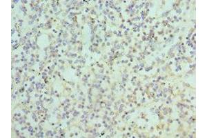 Immunohistochemistry of paraffin-embedded human spleen tissue using ABIN7145108 at dilution of 1:100 (ATG16L1 antibody  (AA 90-300))