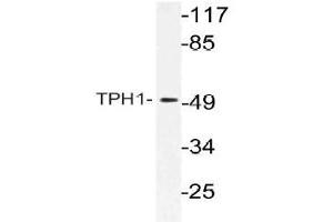 Western blot (WB) analysis of TPH1 antibody in extracts from Jurkat cells. (Tryptophan Hydroxylase 1 antibody)