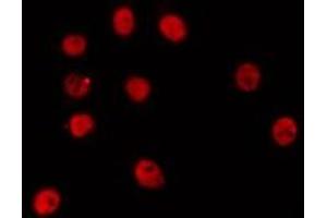 ABIN6274251 staining HepG2 by IF/ICC. (ETV6 antibody  (Internal Region))