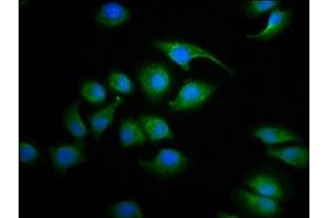 Immunofluorescence staining of A549 cells with ABIN7170898 at 1:100, counter-stained with DAPI.