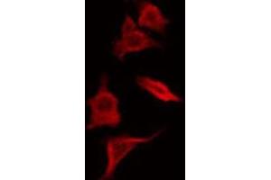 ABIN6266583 staining HepG2 by IF/ICC. (SCGB2A1 antibody  (Internal Region))