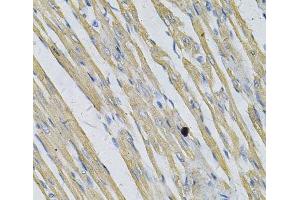 Immunohistochemistry of paraffin-embedded Rat heart using PRNP Polyclonal Antibody at dilution of 1:100 (40x lens). (PRNP antibody)