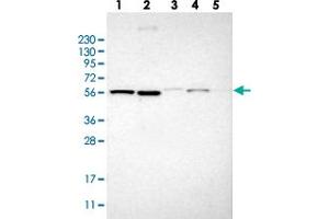 Western blot analysis of Lane 1: RT-4, Lane 2: U-251 MG, Lane 3: Human Plasma, Lane 4: Liver, Lane 5: Tonsil with TMEM194A polyclonal antibody  at 1:250-1:500 dilution. (TMEM194A antibody)