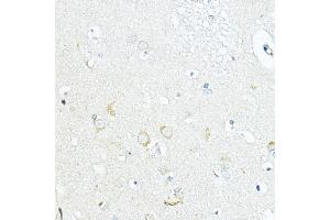 Immunohistochemistry (IHC) image for anti-Leucine Rich Repeat Containing 59 (LRRC59) (AA 1-244) antibody (ABIN6143345)