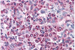 Human Pancreas: Formalin-Fixed, Paraffin-Embedded (FFPE) (TLR3 antibody  (AA 514-657))