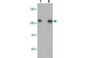 Western blot analysis of TRIM24 in EL4 cell lysate with TRIM24 polyclonal antibody  at (lane 1) 0.