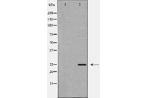 Western blot analysis of CHOP expression in Jurkat cell lysate,The lane on the left is treated with the antigen-specific peptide. (DDIT3 antibody  (Internal Region))