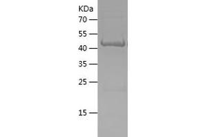 Western Blotting (WB) image for Outer Dense Fiber of Sperm Tails 3 (ODF3) (AA 1-254) protein (His-IF2DI Tag) (ABIN7124284)