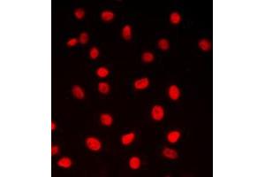 Immunofluorescent analysis of CREB staining in MCF7 cells. (CREB1 antibody  (Center))