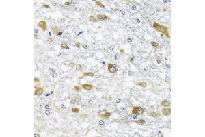 Immunohistochemistry of paraffin-embedded rat brain using DDX39A antibody at dilution of 1:100 (x40 lens).