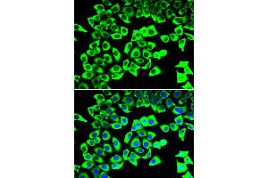 Immunofluorescence analysis of U20S cell using RPLP2 antibody. (RPLP2 antibody)