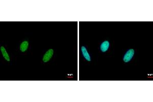 ICC/IF Image RAD18 antibody [N1C1] detects RAD18 protein at nucleus by immunofluorescent analysis.