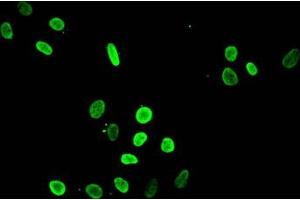 Immunofluorescent analysis of Hela cells treated with NaB using ABIN7139199 at dilution of 1:100 and Alexa Fluor 488-congugated AffiniPure Goat Anti-Rabbit IgG(H+L) (HIST1H4A antibody  (acLys8))
