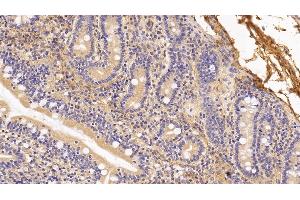 Detection of PIIINP in Human Small intestine Tissue using Monoclonal Antibody to Procollagen III N-Terminal Propeptide (PIIINP)
