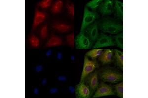 ABIN6259163 and ABIN6274159 staining  cells by IF/ICC. (TACSTD2 antibody  (Internal Region))