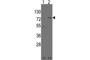 Western blot analysis of Nrf2(Nfe2l2)(arrow) using rabbit polyclonal Nrf2(Nfe2l2) Antibody (N-term) . (NRF2 antibody  (N-Term))