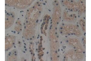 Detection of CK1 in Human Kidney Tissue using Polyclonal Antibody to Cytokeratin 1 (CK1) (Cytokeratin 1 antibody  (AA 487-644))