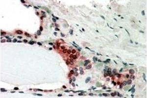In paraffin embedded Human Thyroid Gland shows nclear and cytoplasm staining in activated epithelial cells Recommended concentration, 3-5µg/ml. (COPS2 antibody  (C-Term))