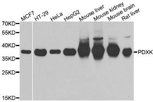 Western blot analysis of extracts of various cell lines, using PDXK antibody. (PDXK antibody)