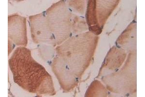 Detection of FBN1 in Rat Skeletal muscle Tissue using Polyclonal Antibody to Fibrillin 1 (FBN1) (Fibrillin 1 antibody  (AA 751-895))